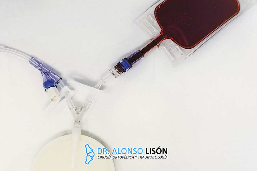 Los monocitos son un tipo de glóbulo blanco o leucocito perteneciente al sistema inmunológico innato. De hecho son los leucocitos de mayor tamaño en la sangre periférica y representan aproximadamente el 2-10% de todos los leucocitos circulantes.
