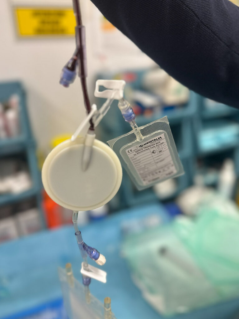 Esta terapia consiste en extraer de la sangre del paciente las células mononucleares con potencial regenerativo (monocitos) a través de un proceso de filtración selectiva 